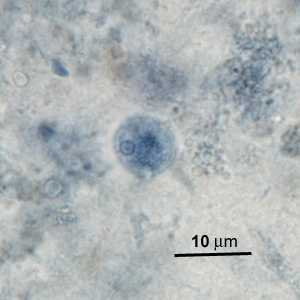 Case276_E