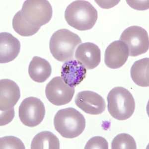 Case277_E