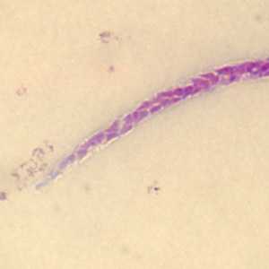 Case279_C