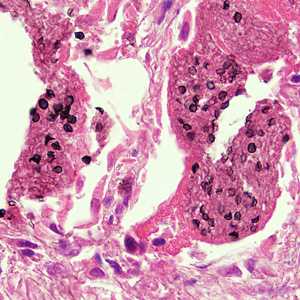 Case282_B