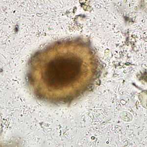 Case284_B