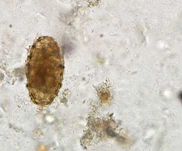 Case284_E
