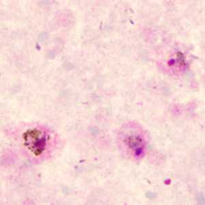 Case285_A