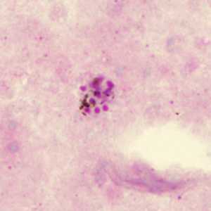 Case285_B