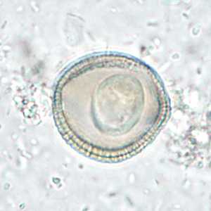 Case286_D