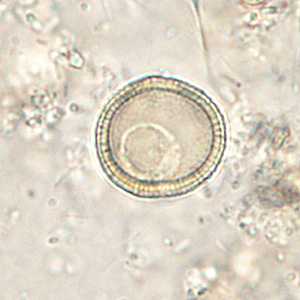 Case286_E
