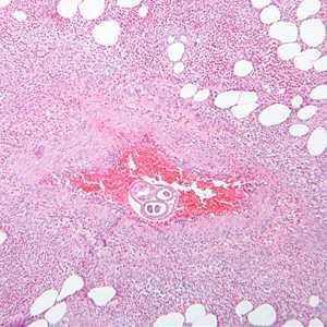 Case289_A