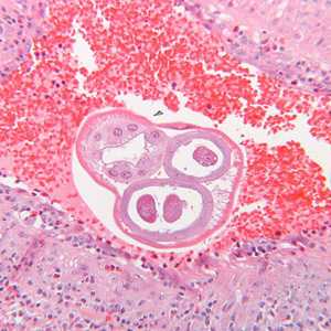 Case289_B