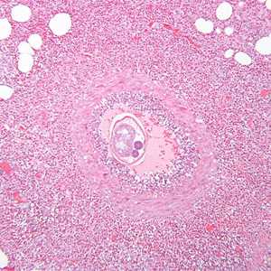 Case289_C
