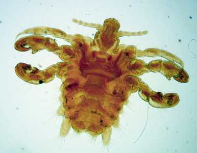 Case292_A