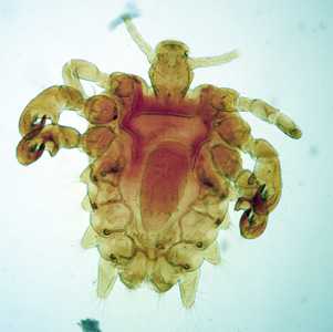 Case292_B