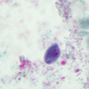 Case293_E