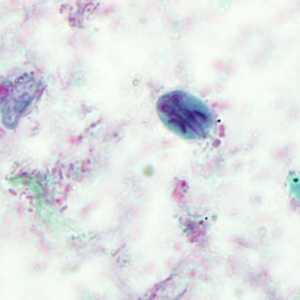 Case293_F