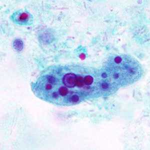 Case296_B