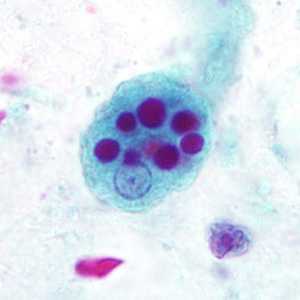 Case296_C