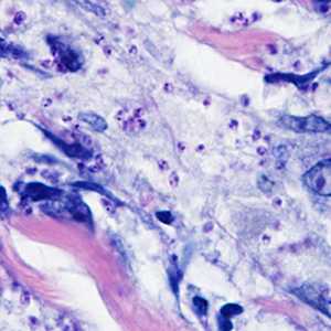Case298_A