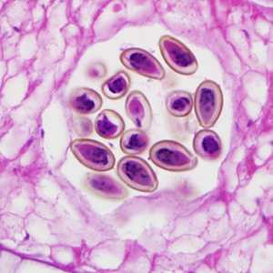 Case299_D