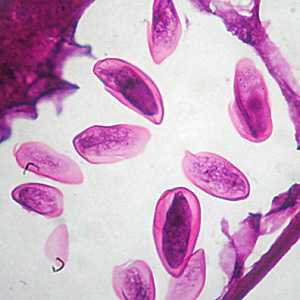 Case305_D