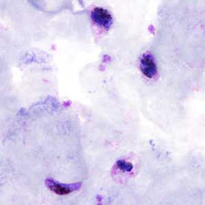 Case306_C