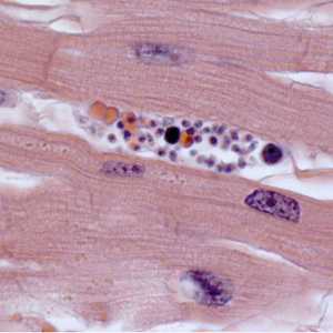 Case308_C