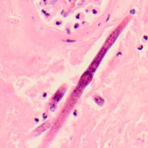 Case319_E