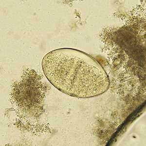 Case329_B