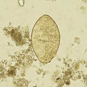Case329_C