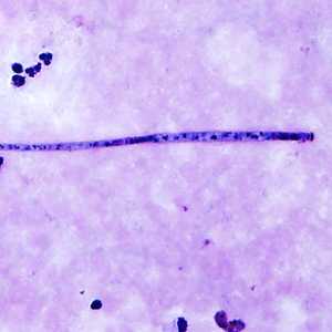 Case339_B