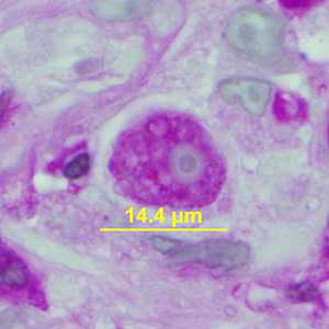 Case341_B