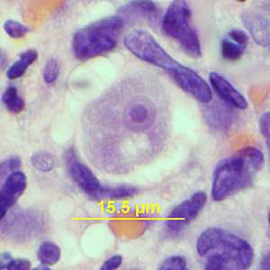 Case341_C
