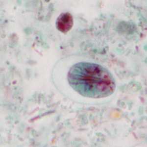 Case351_A