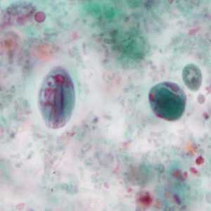 Case351_B