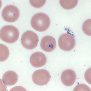 Case354_C