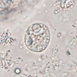 Case365_E