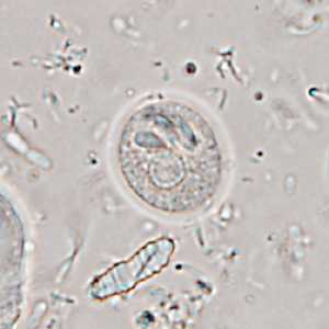 Case365_G