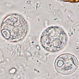 Case365_H