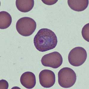 Case368_B