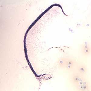Case370_B