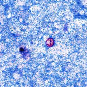 Case374_B