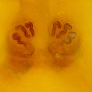 Case379_B