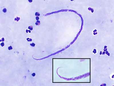 Case382_B