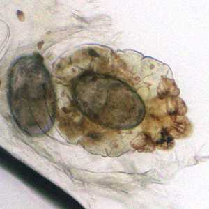 Case383_B