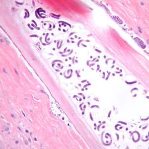 Case384_C
