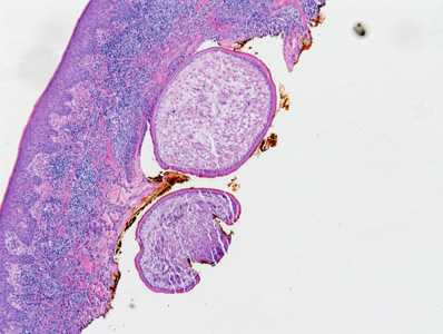 Case Image