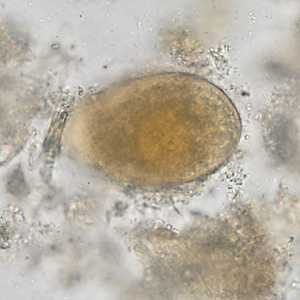 Case Image