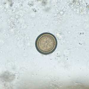Case388_D