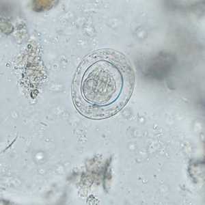 Case388_E