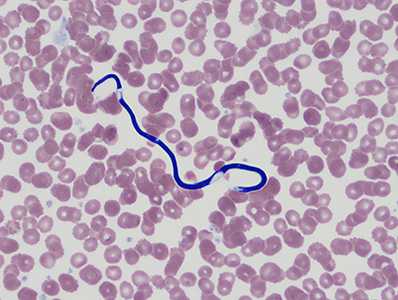 Case Image
