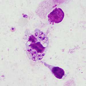 Case Image