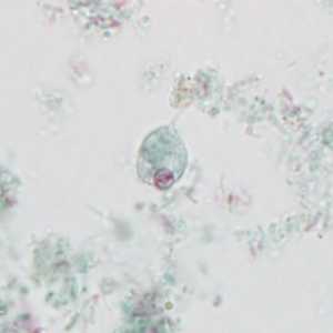 Case Image